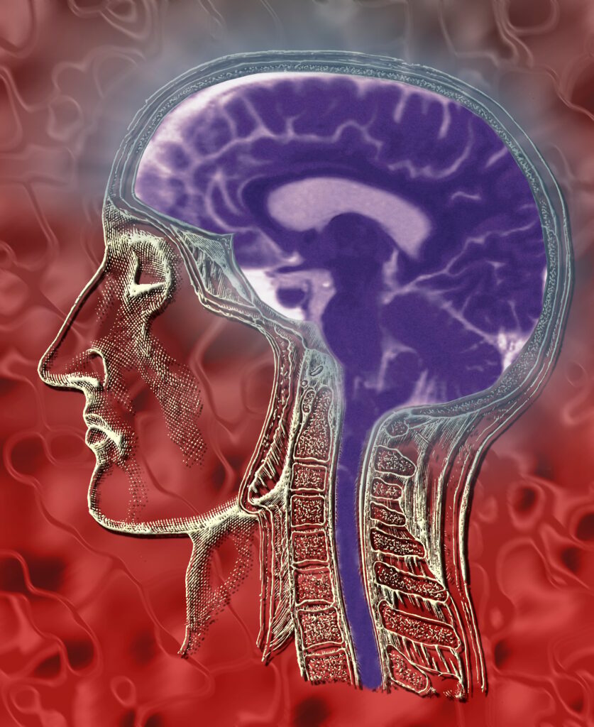Human Brain - Medical Illustration